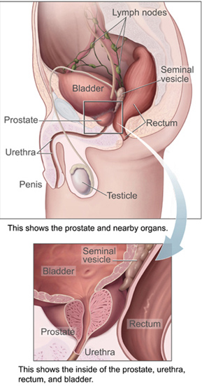 Prostate location