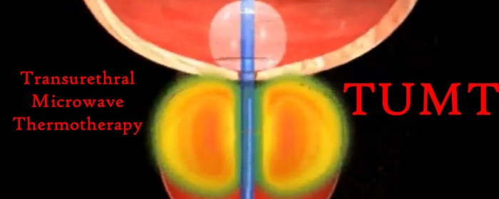 Transurethral Microwave Thermotherapy TUMT