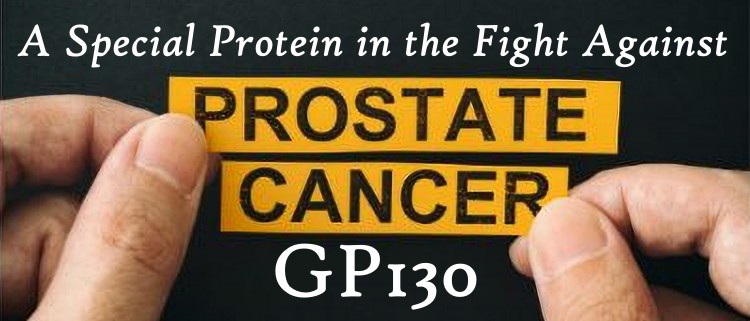 Prostate Cancer and GP130 Protein