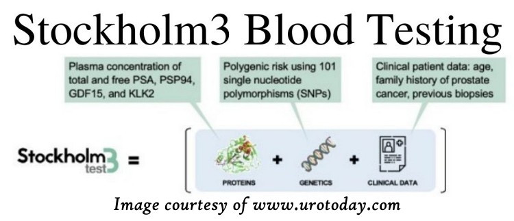 Stockholm3 blood test